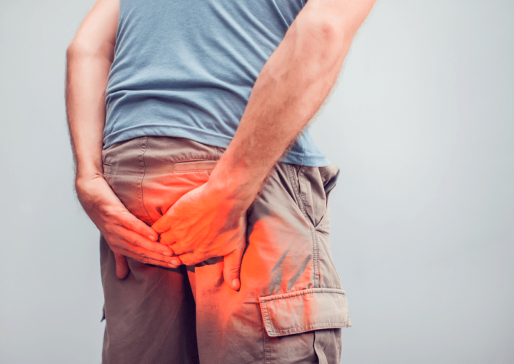 علاج البواسير الخارجية