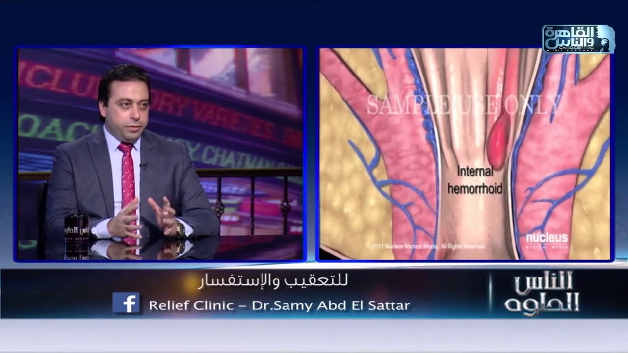 الجهاز الأفضل في تشخيص البواسير البروكتوستيشن