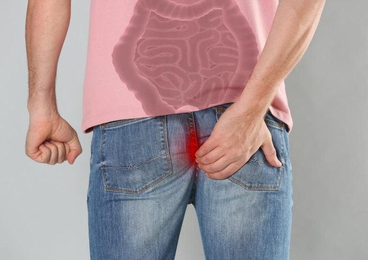 الفرق بين الناسور الشرجي والعصعصي