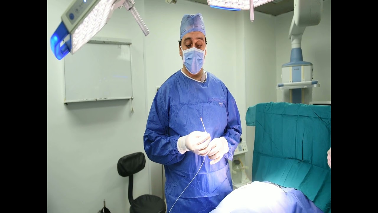 عملية الناسور العصعصي بالليزر