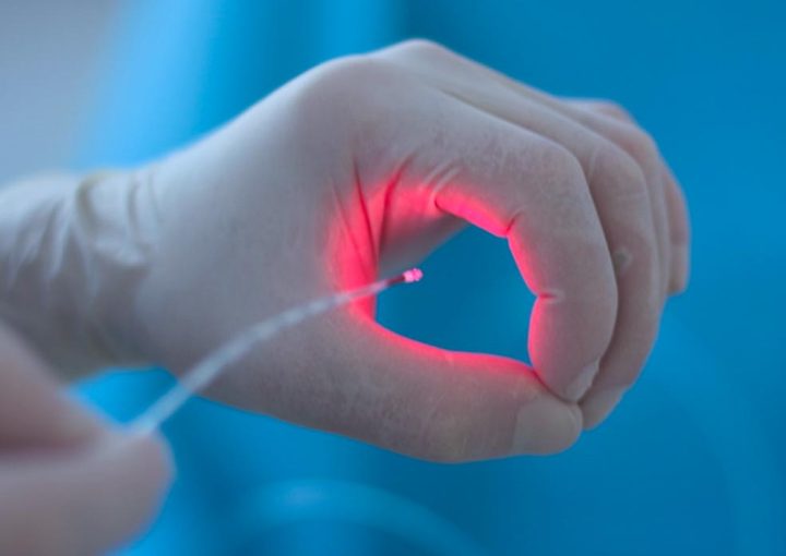 أفضل مركز لعلاج البواسير بالليزر في مصر