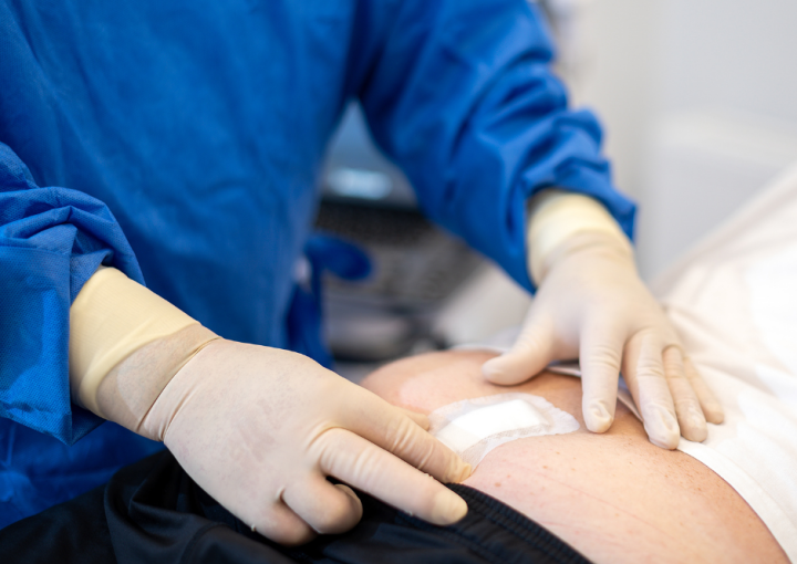 بعد عملية الناسور العصعصي