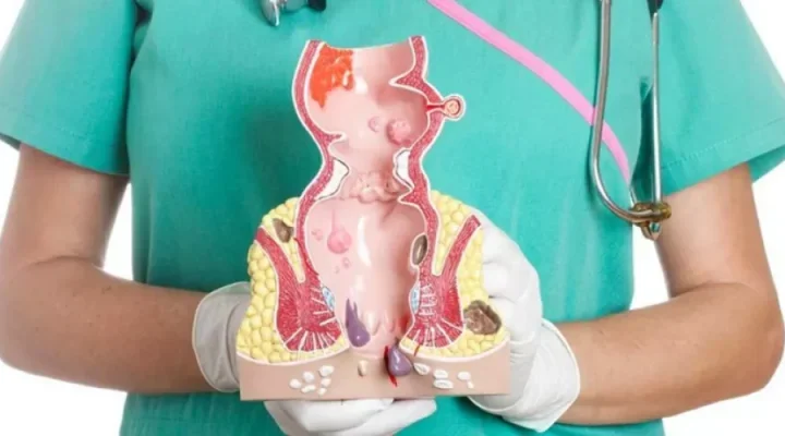 افضل علاج للشق الشرجي