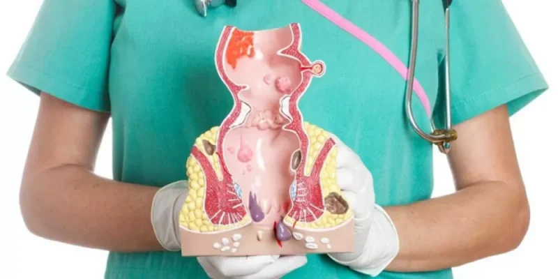 افضل علاج للشق الشرجي