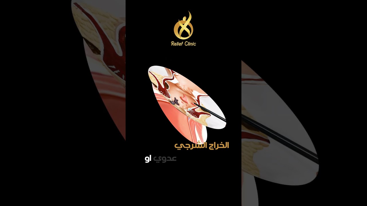 أسباب ألم الشرج