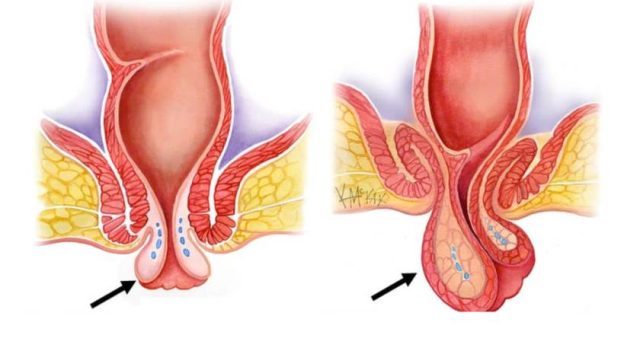 هبوط المستقيم بالصور