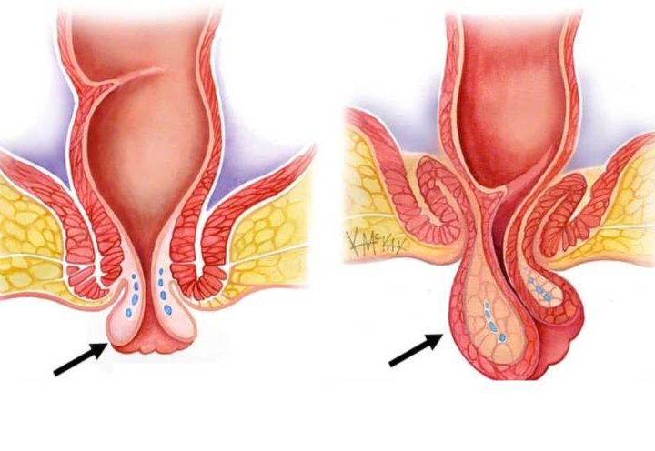 هبوط المستقيم بالصور
