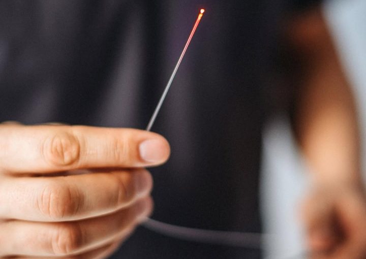 تكلفة عملية الناسور العصعصي بالليزر