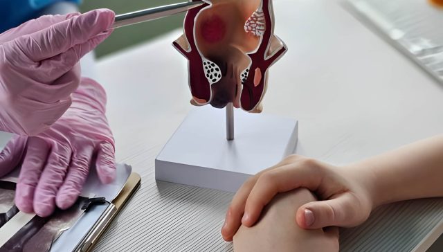 عملية الشرخ الشرجي بالليزر