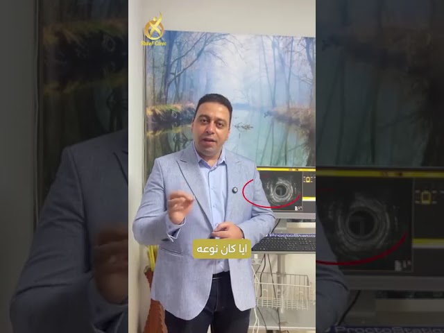 تقنيات علاج الناسور الشرجي