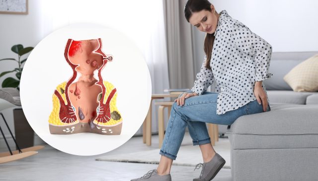 مركز لعلاج الناسور الشرجي بالليزر