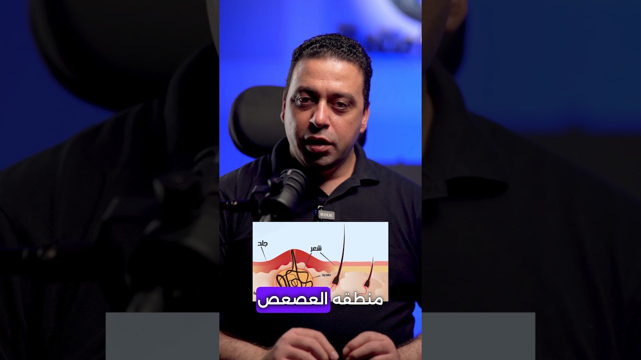 كيفية اكتشاف الناسور العصعصي وعلاجه